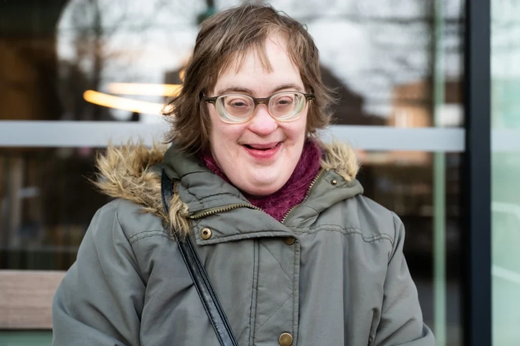 Happy disabled woman with down syndrome smiling at camera